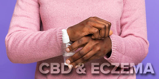 CBD and Eczema: Alternatives for Black Americans