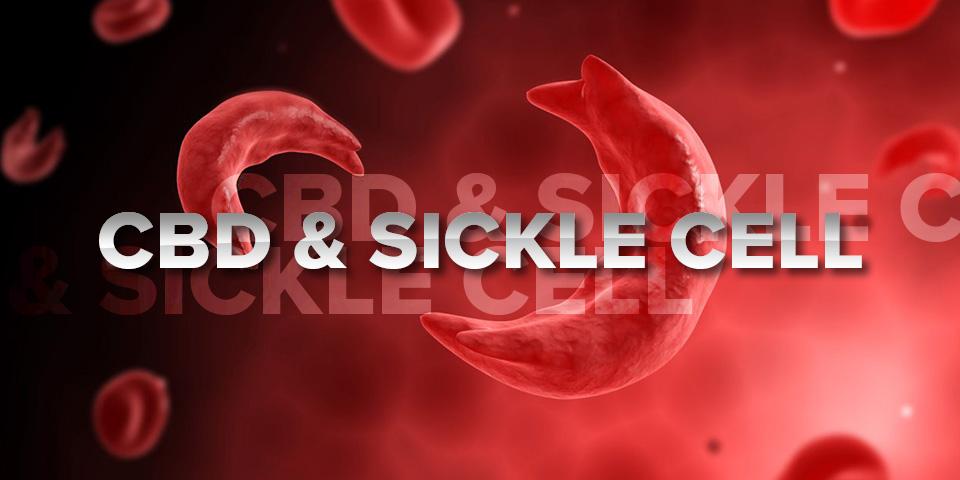 CBD & Sickle Cell Disease: An Option for Black Americans